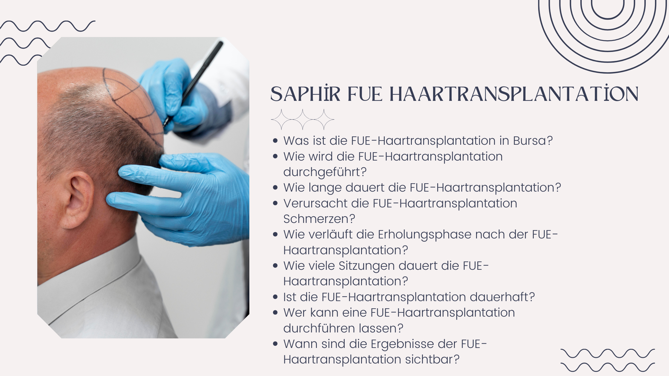 Saphir-Fue-Haartransplantation